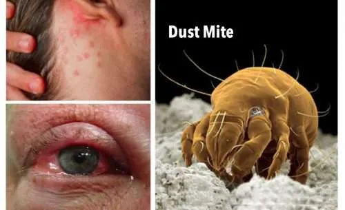 HVAC Duct Cleaning and Dryer Vent Cleaning Services